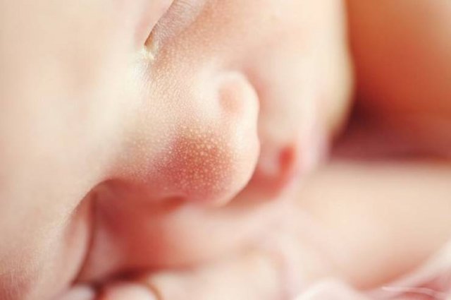 Human Body Facts (17 pics)
