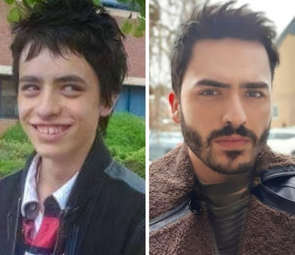 Amazing Ugly Ducklings Transformations (19 pics)