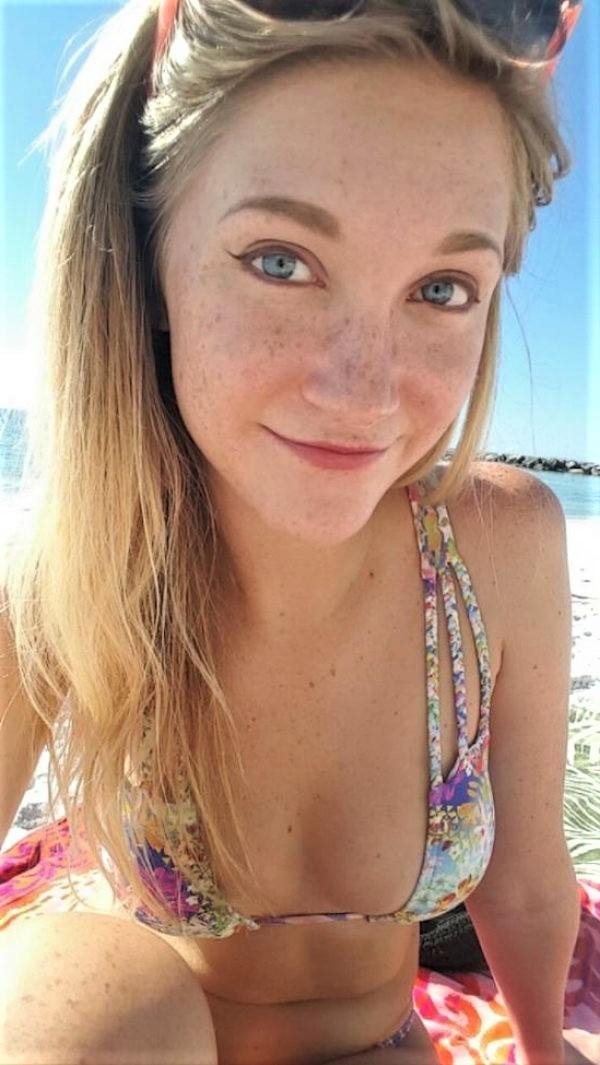 Girls With Freckles (34 pics)