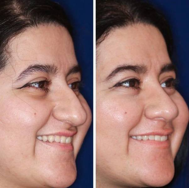 People Show Off Their Transformations (19 pics)