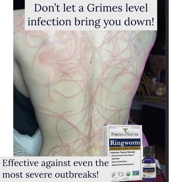 Internet Is Roasting Singer Grimes For 'Alien Scars' Tattoo (19 pics)