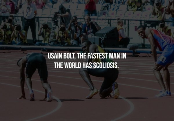 Interesting Facts (25 pics)