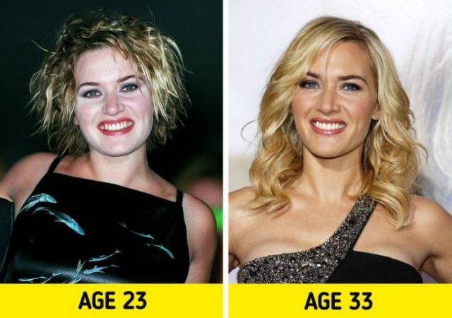 Celebrity Photos: Then And Now (17 pics)