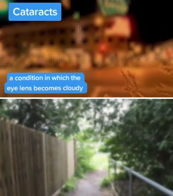 How People See With Different Medical Conditions (23 pics)