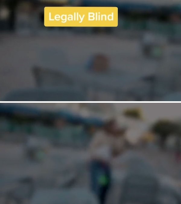 How People See With Different Medical Conditions (23 pics)