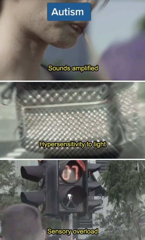 How People See With Different Medical Conditions (23 pics)
