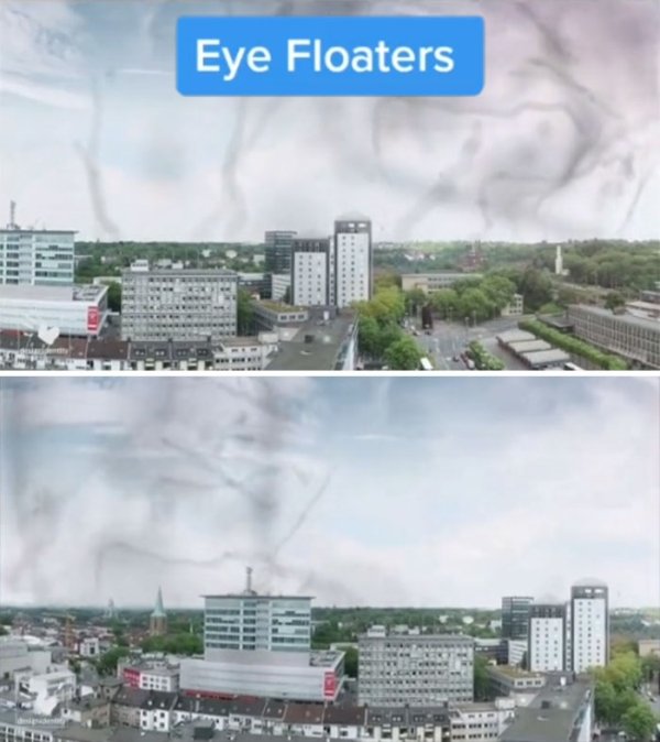 How People See With Different Medical Conditions (23 pics)