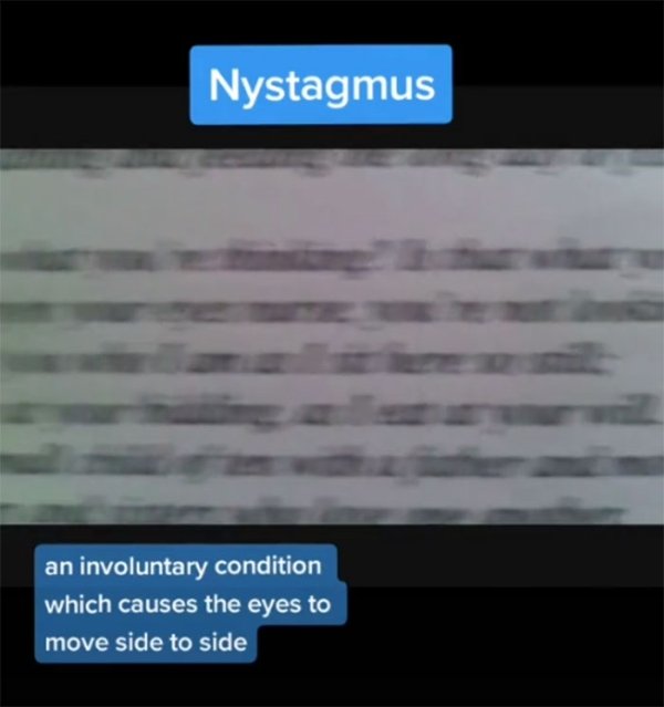 How People See With Different Medical Conditions (23 pics)
