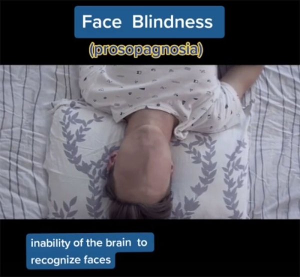 How People See With Different Medical Conditions (23 pics)