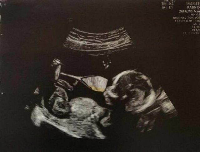Husband Trolls His Wife By 'Ok' Photos Of His Son (30 pics)