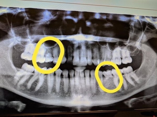 Things Unger X-Rays (21 pics)