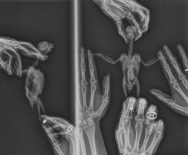 Things Unger X-Rays (21 pics)