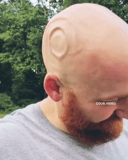 Acid Gifdump, August 10 (25 gifs)
