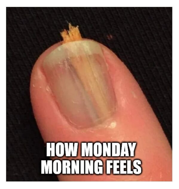 Bad Days Happen (35 pics)