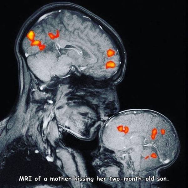 Acid Picdump 2 (74 pics)