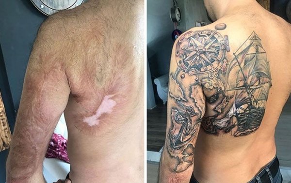 Creative Tattoos That Cover Scars (32 pics)