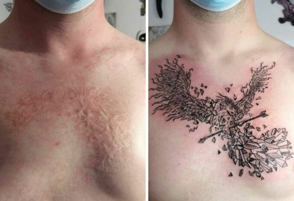 Creative Tattoos That Cover Scars (32 pics)