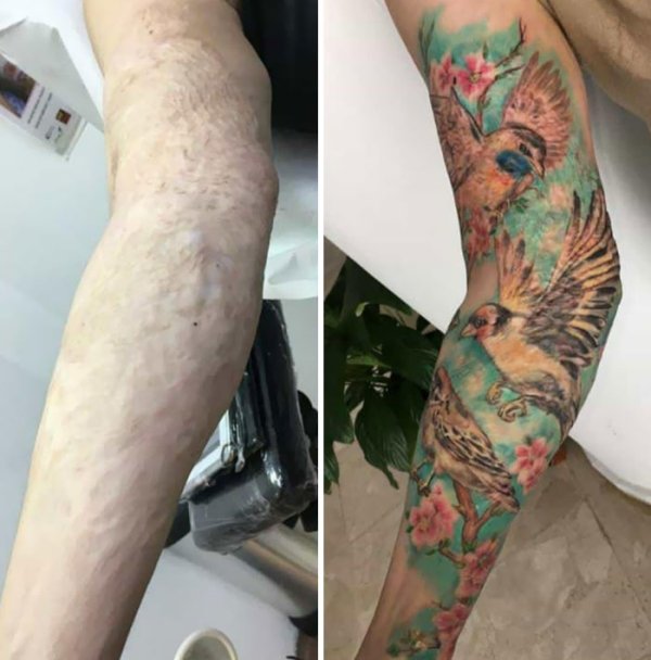 Creative Tattoos That Cover Scars (32 pics)