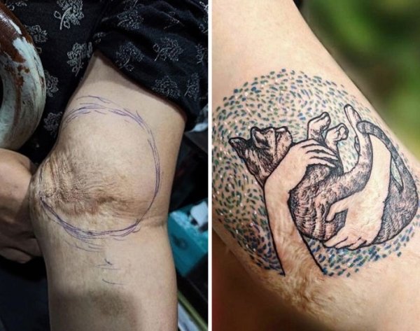 Creative Tattoos That Cover Scars (32 pics)