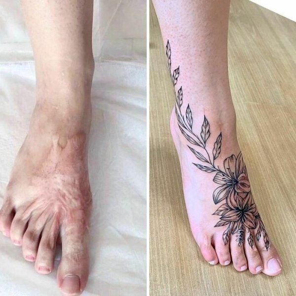 Creative Tattoos That Cover Scars (32 pics)