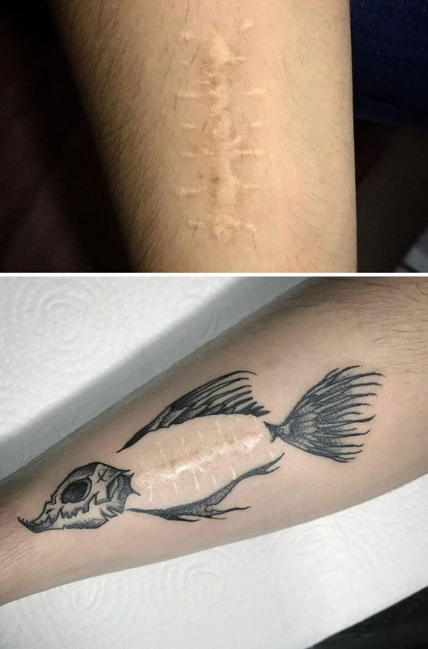 Creative Tattoos That Cover Scars (32 pics)