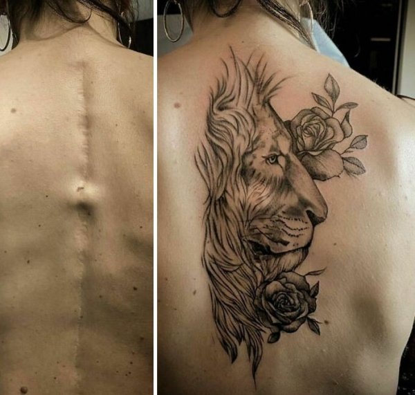 Creative Tattoos That Cover Scars (32 pics)