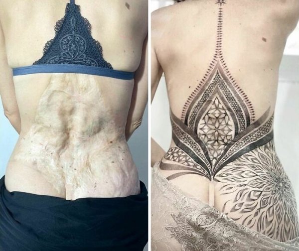Creative Tattoos That Cover Scars (32 pics)