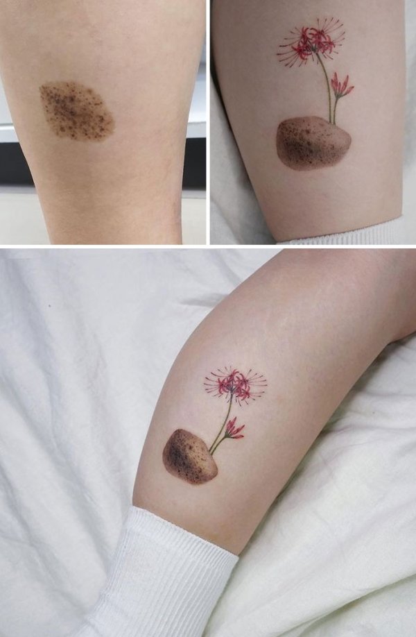Creative Tattoos That Cover Scars (32 pics)