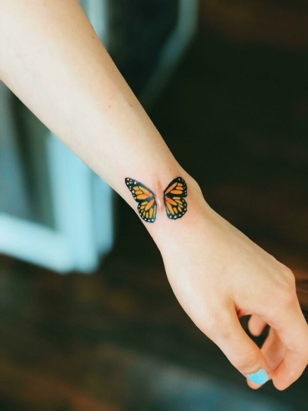 Creative Tattoos That Cover Scars (32 pics)