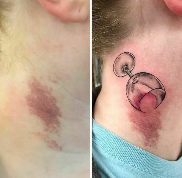 Creative Tattoos That Cover Scars (32 pics)