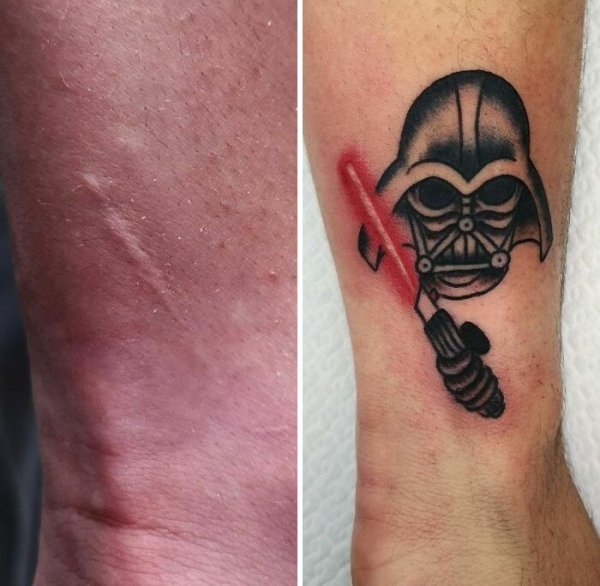Creative Tattoos That Cover Scars (32 pics)