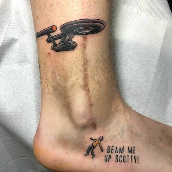 Creative Tattoos That Cover Scars (32 pics)
