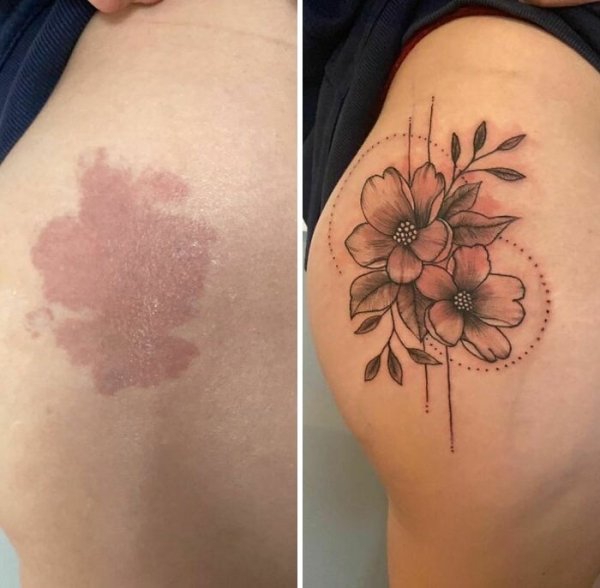 Creative Tattoos That Cover Scars (32 pics)