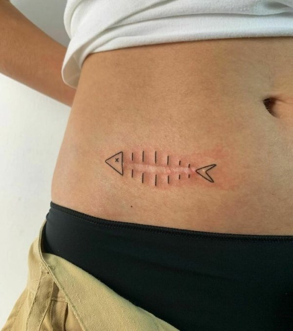 Creative Tattoos That Cover Scars (32 pics)