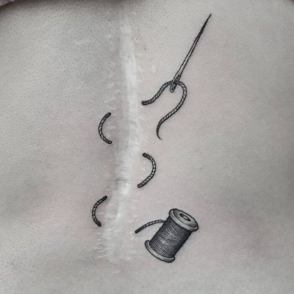 Creative Tattoos That Cover Scars (32 pics)