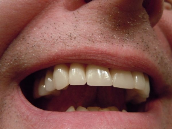 Human Body Facts (30 pics)