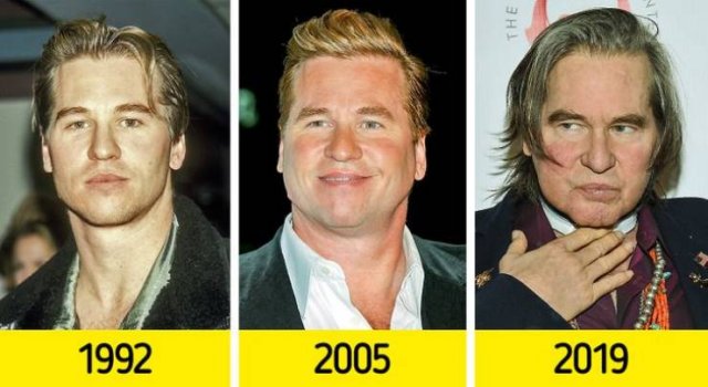 Celebrity Changes (10 pics)