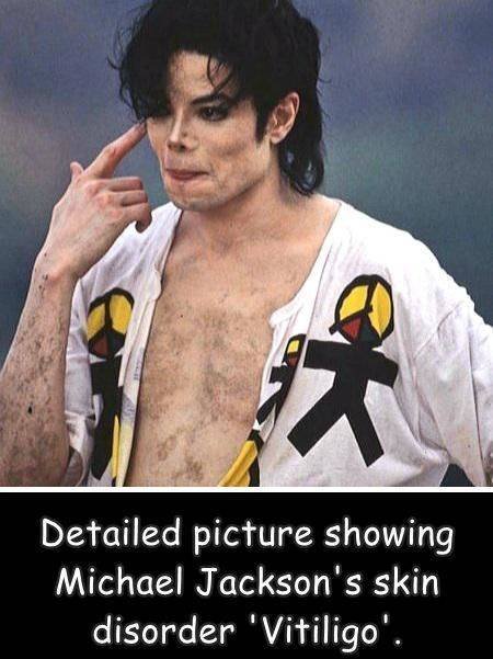 Acid Picdump 2 (82 pics)