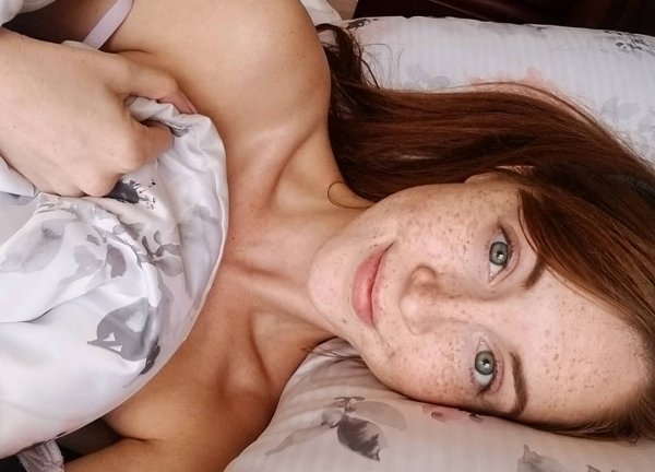 Girls With Freckles (35 pics)