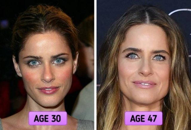 Celebrities Who Prefer Natural Aging (15 pics)