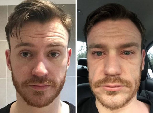 Before And After Photos (15 pics) Before And After Photos (15 pics)