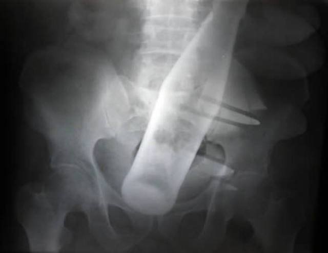Unusual X-Ray Photos (22 pics)