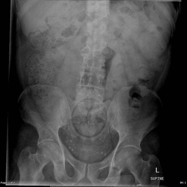 Unusual X-Ray Photos (22 pics)