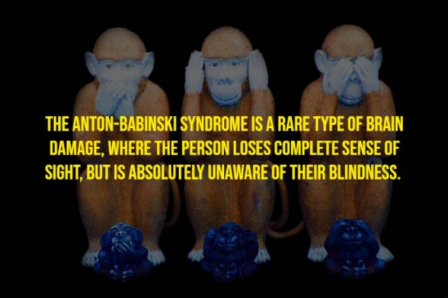 Random Facts (17 pics)