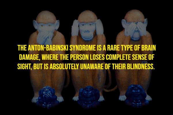 Random Facts (17 pics)