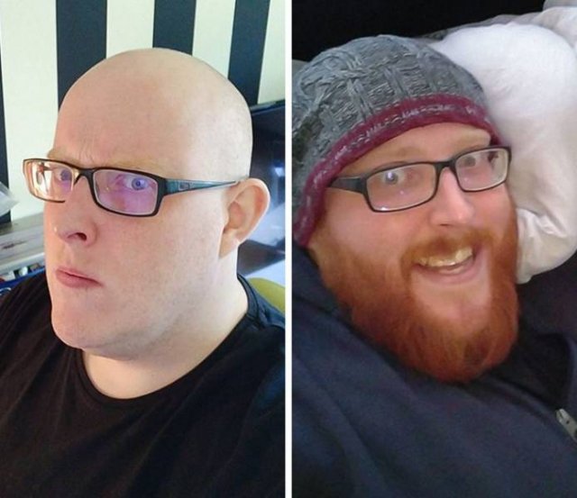 With And Without Beard (20 pics)