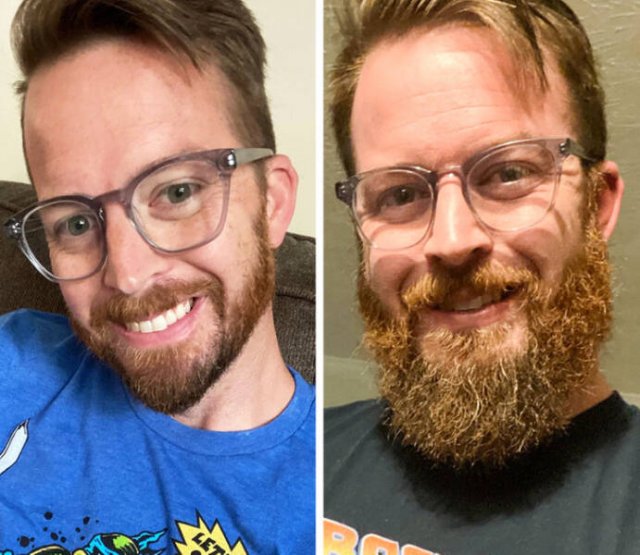 With And Without Beard (15 pics)
