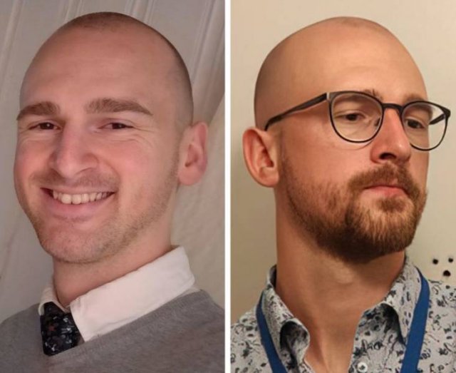 With And Without Beard (18 pics)