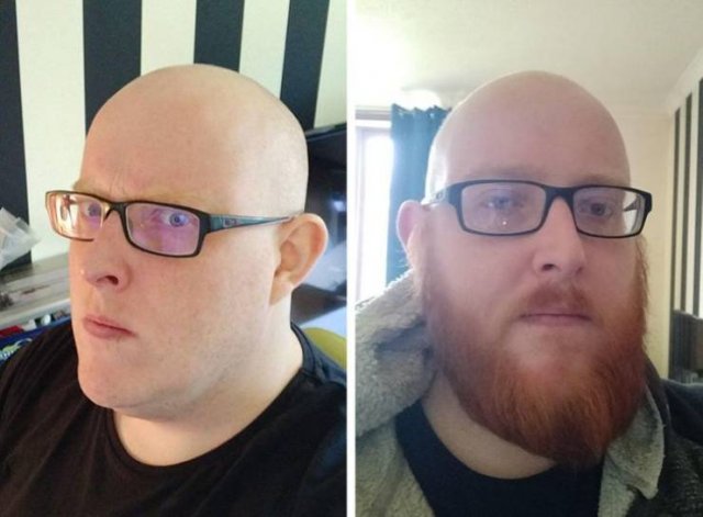 With And Without Beard (18 pics)