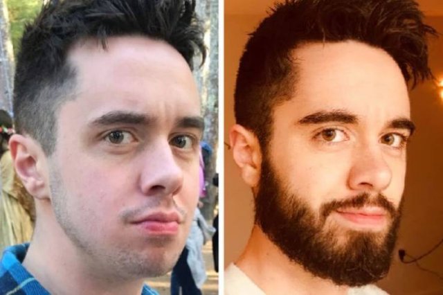 With And Without Beard (18 pics)